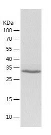Recombinant Human PIM2