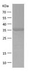 Recombinant Human UPB1