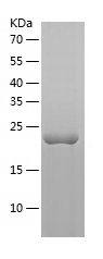 Recombinant Human SAT2