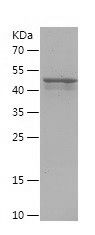 Recombinant Human RRM2