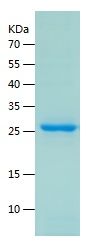 Recombinant Human NQO2