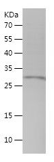 Recombinant Human TMEM35A