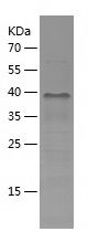 Recombinant Human TSSC4