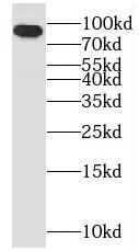 OSBP antibody