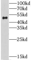 GPATCH4 antibody