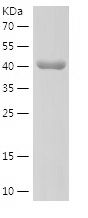 Recombinant Human SP1
