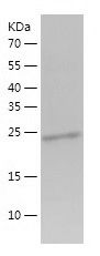 Recombinant Human PRDM12