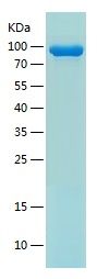 Recombinant Human TSLPR&IL-7RA Heterodimer