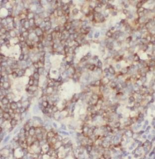 CR2 antibody