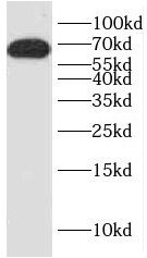 HNF1A antibody
