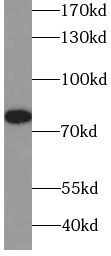 RIPK1-Specific antibody