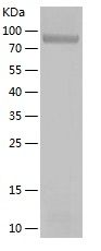 Recombinant Human LTF
