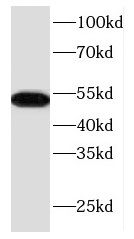KRT17 antibody