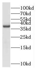 NDRG4 antibody
