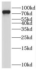 PALMD antibody