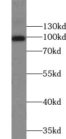 TRPC6 antibody