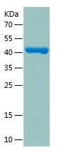 Recombinant Human MGLL