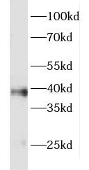 FOXR2 antibody