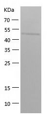 Recombinant Human SEPTIN6