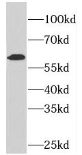 PDE1A antibody