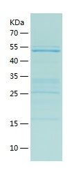 Recombinant Human ADSS2