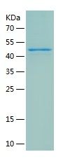 Recombinant Human RIC8B