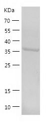 Recombinant Human RTCA