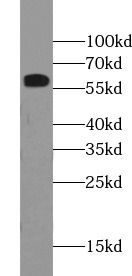 CNDP1 antibody