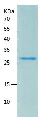 Recombinant Human MAGED1
