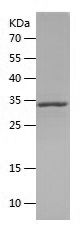Recombinant Human PTH