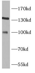 TRIM37 antibody