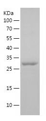 Recombinant Human FER