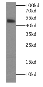 HCRTR1 antibody