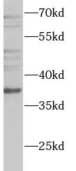 WDR5 antibody
