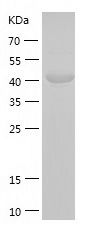 Recombinant Human ACY1