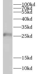 CRISP2 antibody