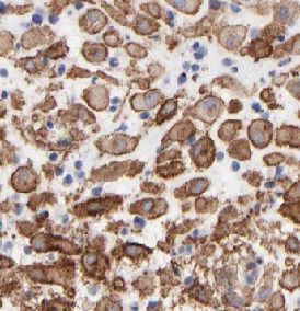 CPZ antibody
