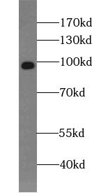 HCN2 antibody