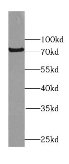 FERMT2 antibody