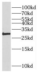 PARP11 antibody