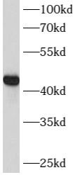 LMX1B antibody