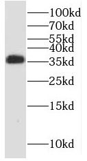 PPP2CB antibody