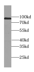 USP13 antibody