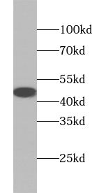 AARSD1 antibody