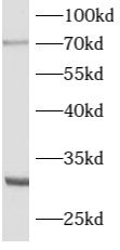 ATG16L2 antibody