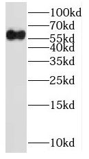 NOC4L antibody