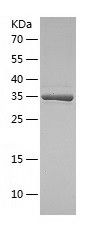 Recombinant Human DERA