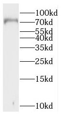 RAD17 antibody