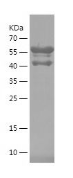 Recombinant Human FKBP5
