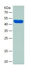 Recombinant Human NSFL1C